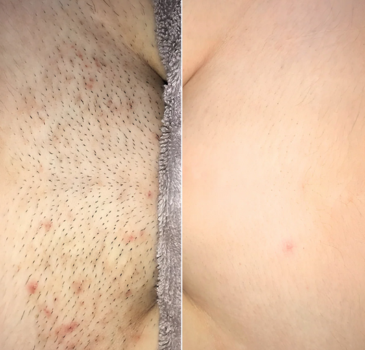 Smooth Moves - Metal Safety Razor