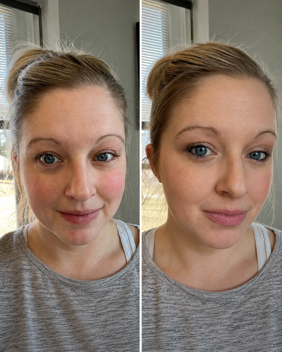 3 Step Face result