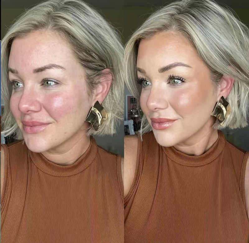 Still my skin