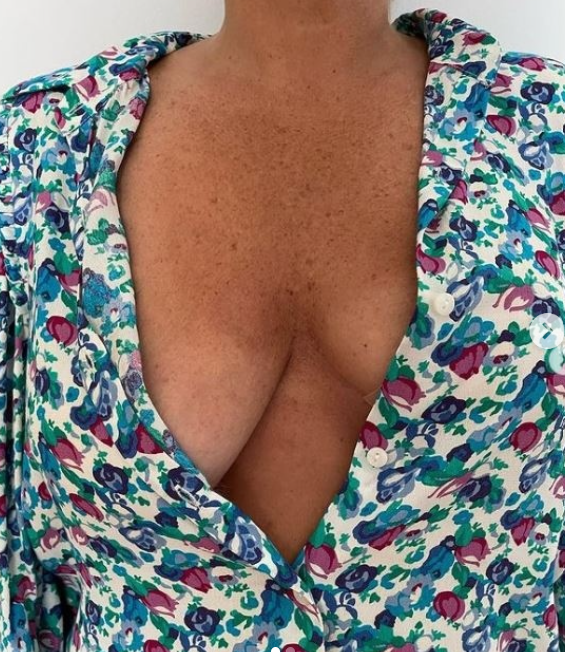 tits up tape before and after