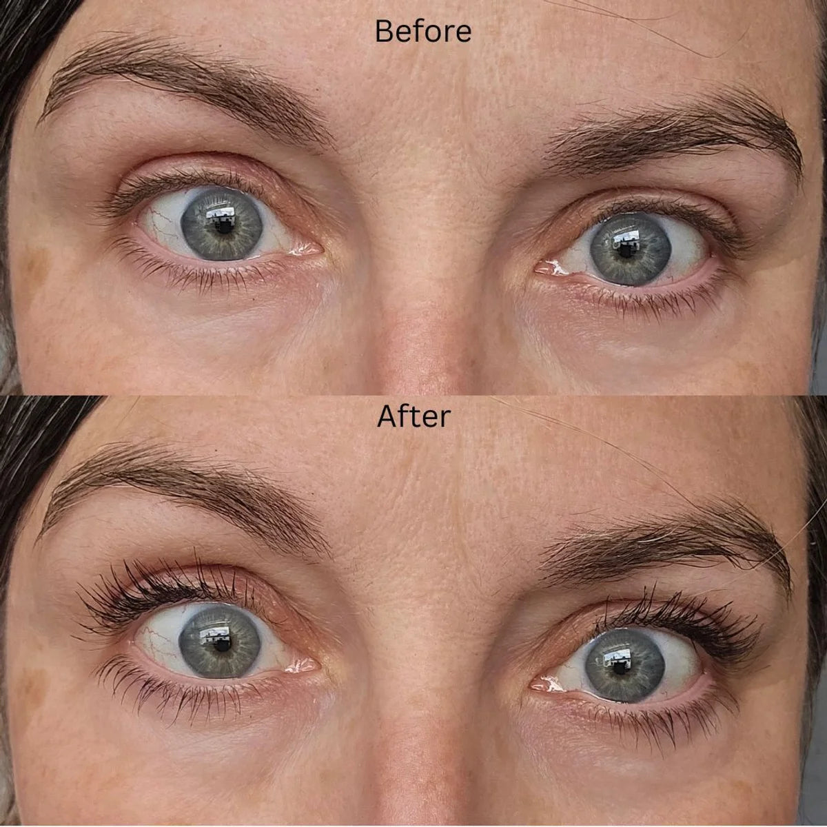  before and after