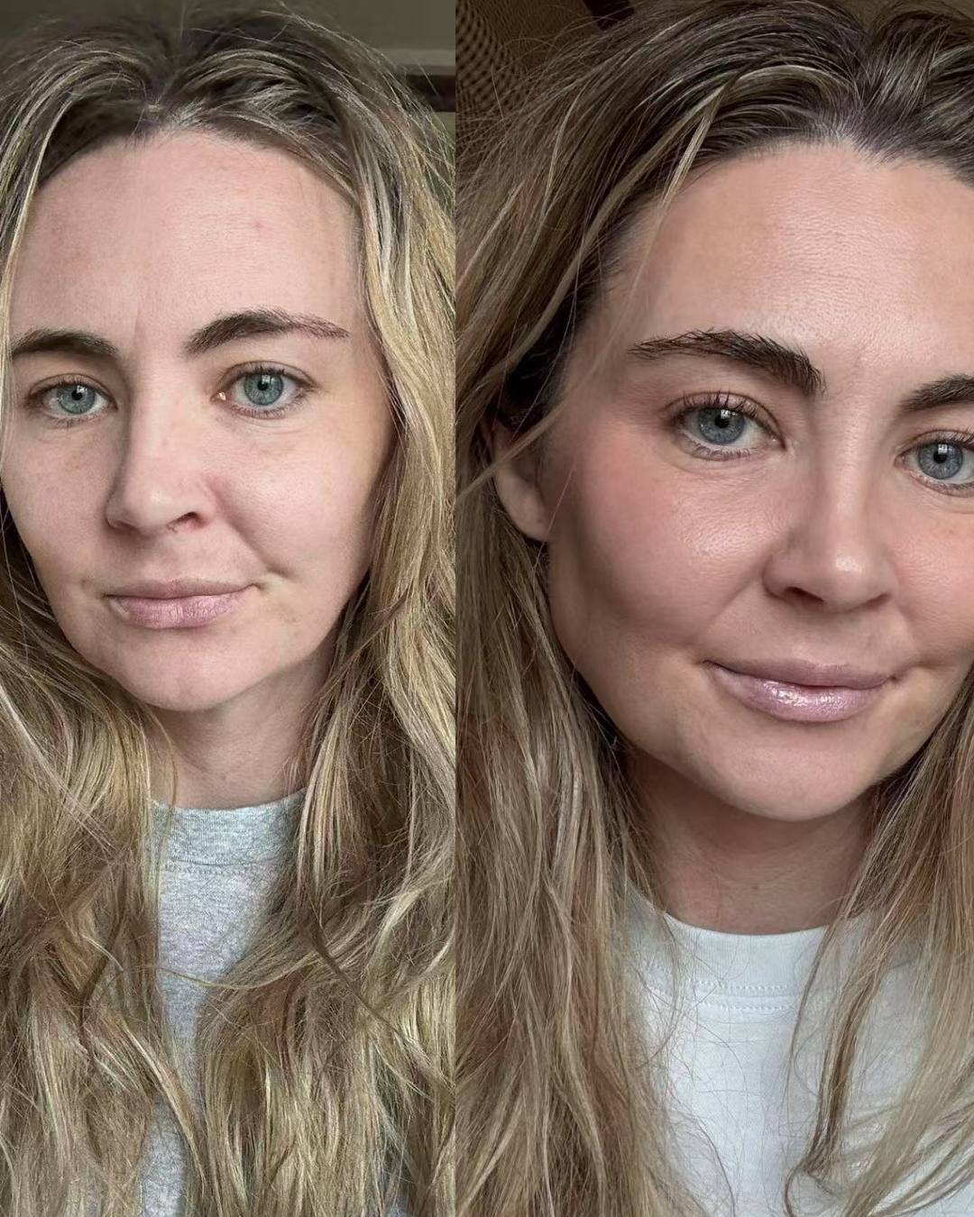  before and after