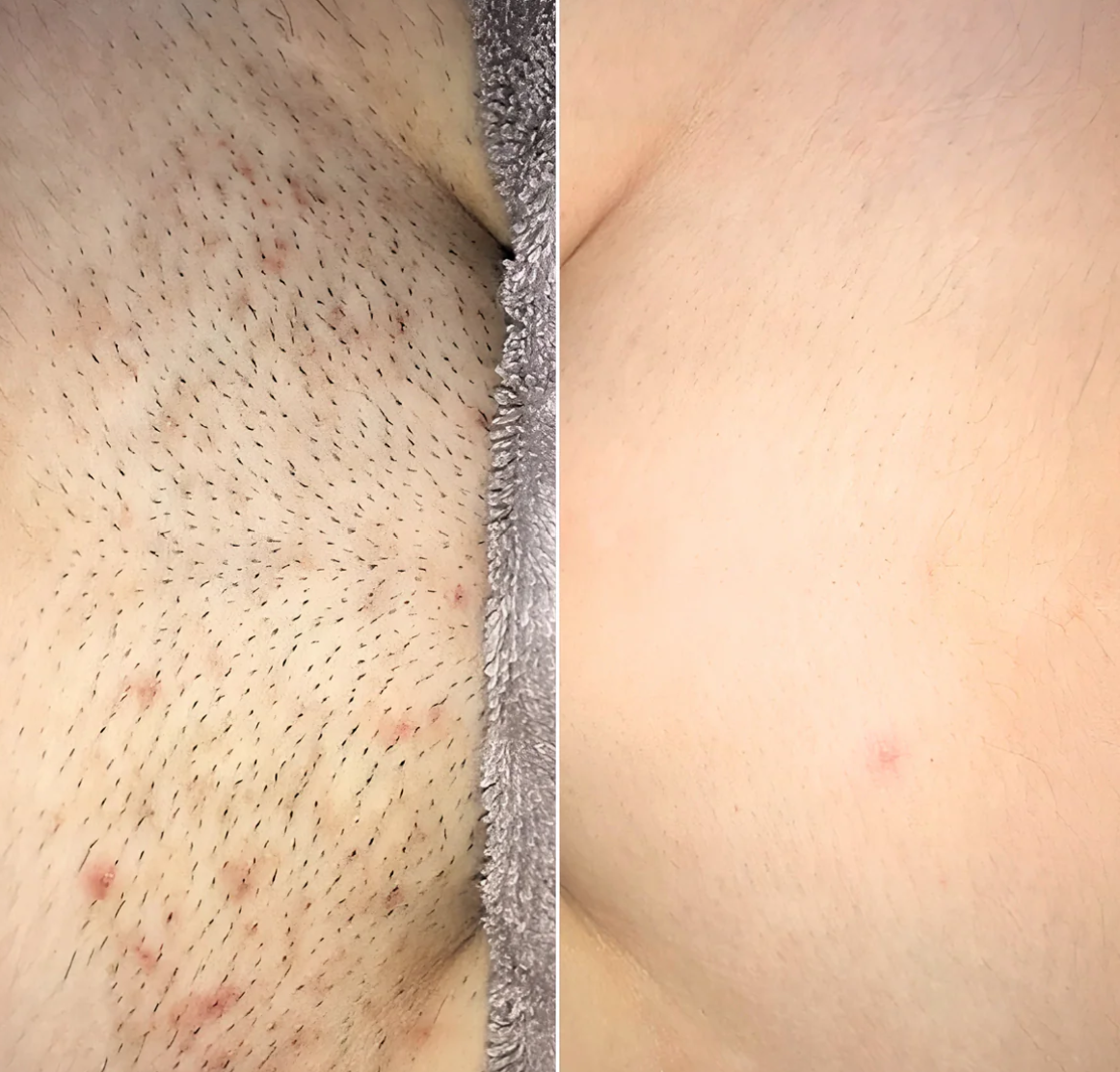 Smooth Moves - Metal Safety Razor