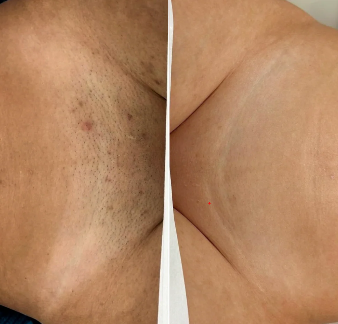 Smooth Moves - Metal Safety Razor