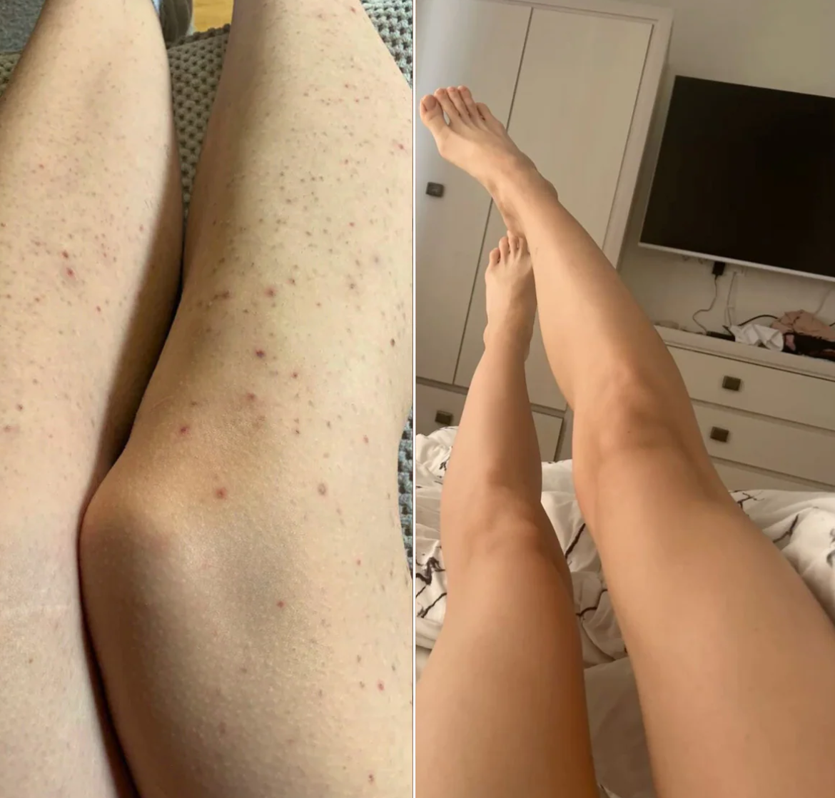 Smooth Moves - Metal Safety Razor