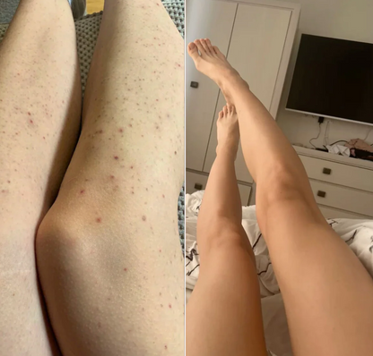 Smooth Moves - Metal Safety Razor