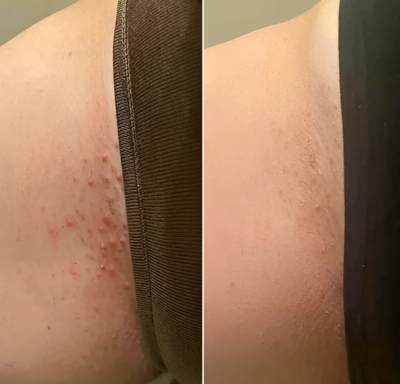 Smooth Moves - Metal Safety Razor