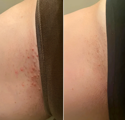 Smooth Moves - Metal Safety Razor