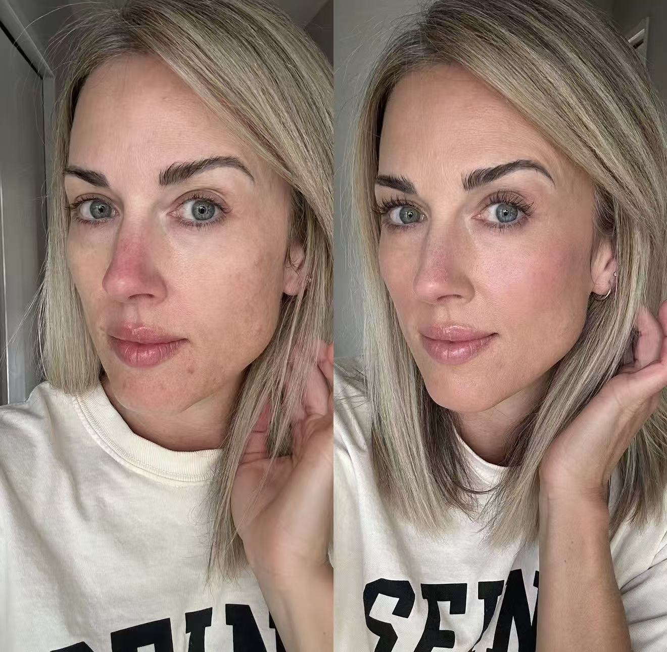 Sarah, Christchurch before and after