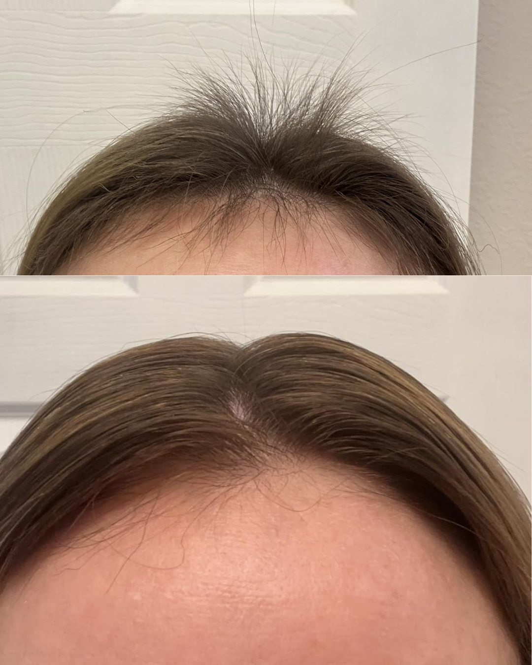  before and after