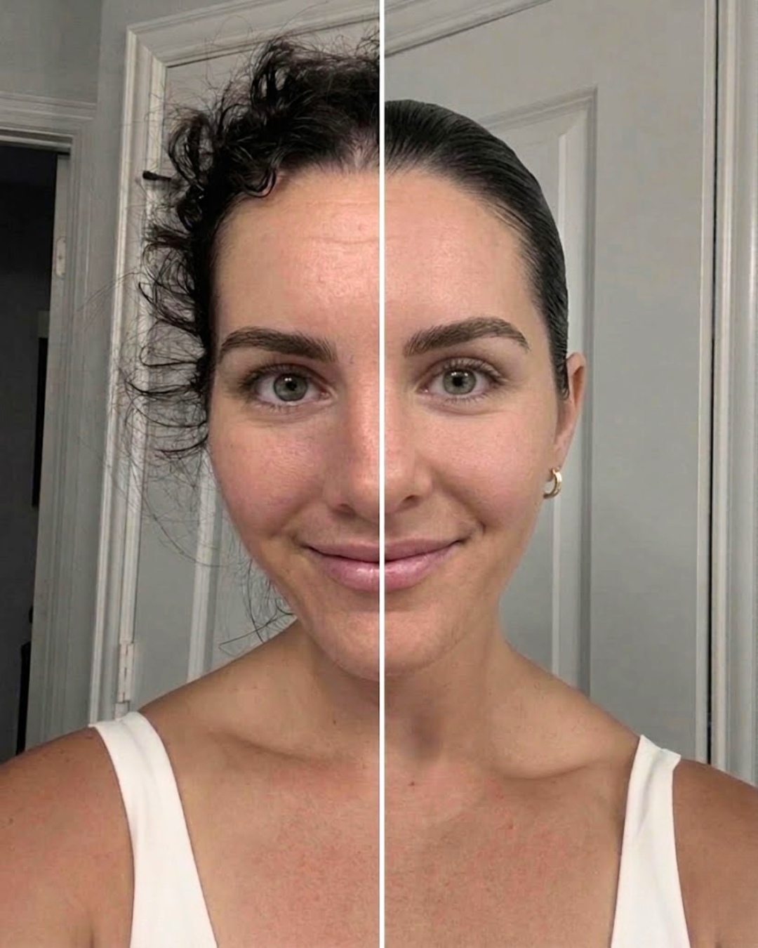 before and after