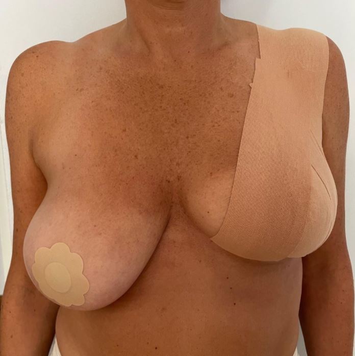 Tits Up Ultimate Tit Kit - titsuptape before and after