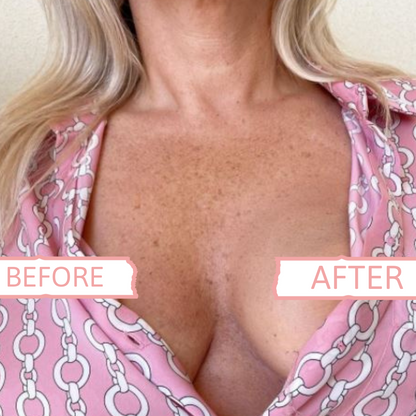 Tits Up Ultimate Tit Kit