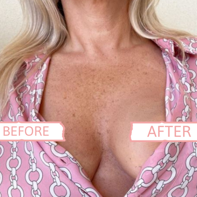 Tits Up Ultimate Tit Kit