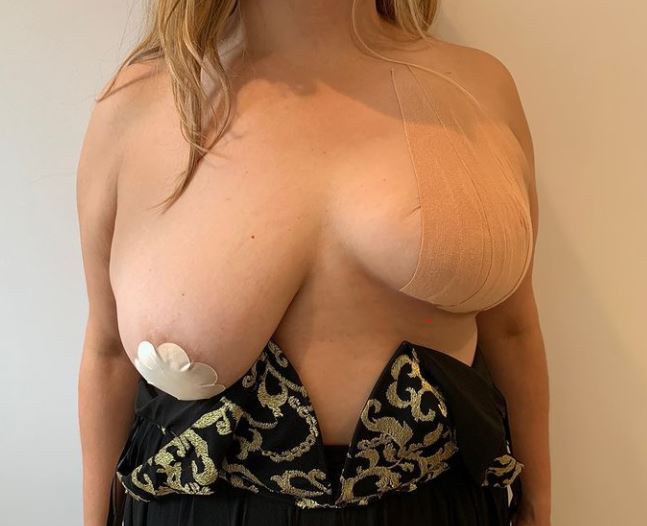 tits up Nude Boob Tape before and after